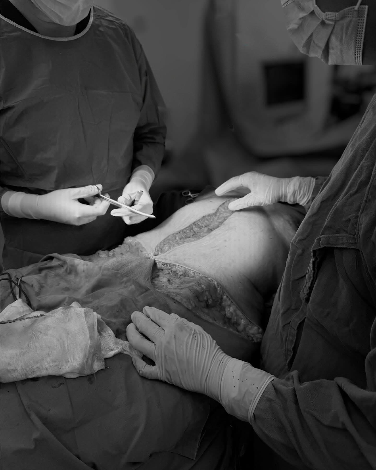 MyDoctors team during surgery